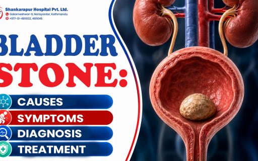 Bladder Stone: Causes, Symptoms, Diagnosis and Treatment